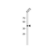 Signal Regulatory Protein Beta 1 (SIRPB1) Antibody