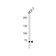 TSPY Like 2 (TSPYL2) Antibody