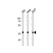 Ubiquitin C-Terminal Hydrolase UCH37 (UCH37) Antibody