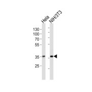 NF-Kappa-B Inhibitor Alpha (NFKBIA) Antibody