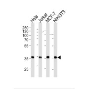 Nucleophosmin (NPM1) Antibody