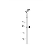 Protein Cappuccino Homolog (CNO) Antibody