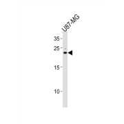 Ciliary Neurotrophic Factor (CNTF) Antibody