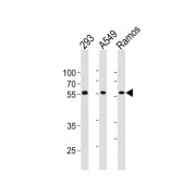 Tripartite Motif-Containing Protein 6 (TRIM6) Antibody