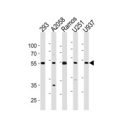 Cell Division Cycle Associated 7 Like (CDCA7L) Antibody