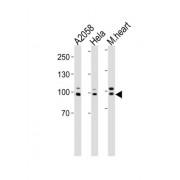 Enhancer of Polycomb Homolog 1 (EPC1) Antibody