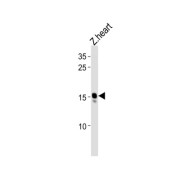 NADH Ubiquinone Oxidoreductase 1 Alpha Complex Assembly Factor 3 (NDUFAF3) Antibody