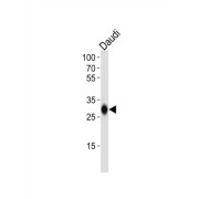 HLA Class II Histocompatibility Antigen, DQ Beta 1 Chain (HLA-DQB1) Antibody