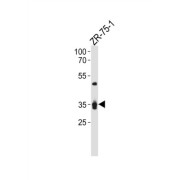 Interleukin 3 Receptor alpha (IL3RA) Antibody