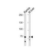 Toll Like Receptor Adaptor Molecule 1 (TICAM1) Antibody