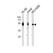 Proto-Oncogene Tyrosine-Protein Kinase LCK (LCK) Antibody