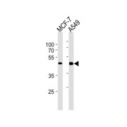 Cyclin-Dependent Kinase 20 (CDK20) Antibody