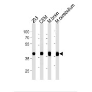 Aldolase C, Fructose Bisphosphate (ALDOC) Antibody