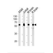 Ubiquitin Carboxyl-Terminal Hydrolase 14 (USP14) Antibody