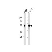 Serine/threonine-Protein Kinase VRK1 (VRK1) Antibody