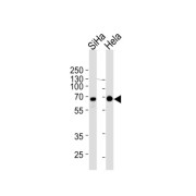 Serine/threonine-Protein Kinase NLK (NLK) Antibody