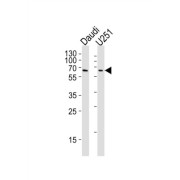 Yin Yang 1 (YY1) Antibody