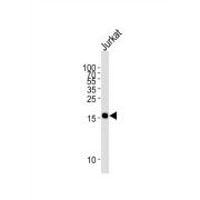 Glia Maturation Factor Gamma (GMFG) Antibody