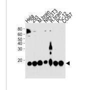 Peptidyl-Prolyl Cis-Trans Isomerase NIMA-Interacting 1 (PIN1) Antibody