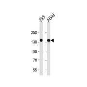 Vascular Endothelial Growth Factor Receptor 3 / VEGFR3 (FLT4) Antibody