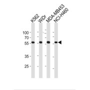 Nuclear Pore Complex-Interacting Protein-Like 2 (NPIPL2) Antibody