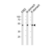 Bleomycin Hydrolase (BLMH) Antibody