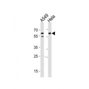 Membrane Cofactor Protein (CD46) Antibody