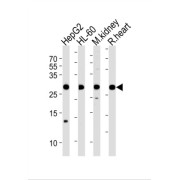 ATP Synthase F(0) Complex Subunit B1, Mitochondrial (ATP5PB) Antibody