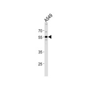 Periphilin 1 (PPHLN1) Antibody