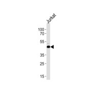 Autophagy Related 4B Cysteine Peptidase (ATG4B) Antibody