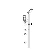 Cellular Tumor Antigen P53 (TP53) Antibody