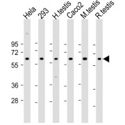 WB analysis of (1) HeLa whole cell lysate, (2) 293 whole cell lysate, (3) human testis lysate, (4) Caco2 whole cell lysate, (5) mouse testis lysate, and (6) rat testis lysate, using SLC2A8 Antibody (1/2000 dilution). Predicted band size : 51 kDa. Blocking/Dilution buffer: 5% NFDM/TBST.