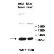 Western blot analysis of fetal brain and mouse brain lysates, using UCHL1 antibody.