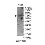 Western blot analysis of A431 cell lysates, using FRMD6 antibody.