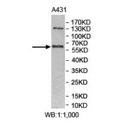 Makorin Ring Finger Protein 3 (MKRN3) Antibody