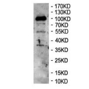 Western blot analysis of SMCC-7721 cell lysates using GATOR Complex Protein DEPDC5 Antibody.