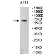 WB analysis of A431 cell lysates, using FCRL5 antibody (1/200 dilution).
