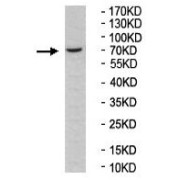 Western blot analysis of HeLa cell lysate, using ZNF844 Antibody (1/500 dilution).