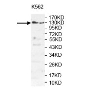 WB analysis of extract of K562 cell lysate using anti-PLEKHG3 antibody (1/1000 dilution).