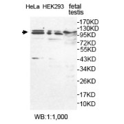 Western blot analysis of feteal testis, HeLa and HEK293 cell lysates, using USP29 antibody.