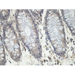 UDP-Glucuronosyltransferase 2A3 (UGT2A3) Antibody