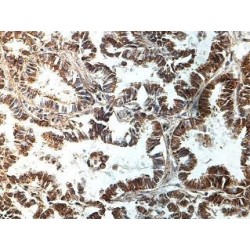 Guanylate Binding Protein 6 (GBP6) Antibody