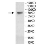 WB analysis of A-431 cell lysates, using GBP6 Antibody (1/1000 dilution).