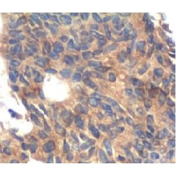 Cyclin Dependent Kinase Inhibitor 1A / p21 (CDKN1A) Antibody