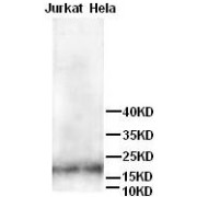 WB analysis of Jurkat and HeLa cells.