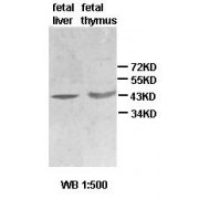 Western blot analysis of fetal liver and thymus lysate, using ACTBL2 antibody.