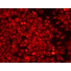 Caspase 7 (CASP7) Antibody