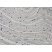 IHC analysis of formalin-fixed paraffin-embedded skeletal muscle with cytoplasmic staining using PI3K p85 antibody (dilution 1:100).