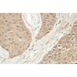 Vascular Endothelial Growth Factor A (VEGFA) Antibody