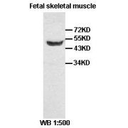 WB analysis of fetal skeletal muscle tissue, using VEGFA antibody.